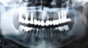 An x-ray of the teeth and jaws