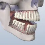Missing Tooth